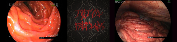 Total Reflux: grindcore Tanka Balázstól és Édes Gergőtől