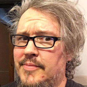 Ismét növekedésnek indult James Murphy agydaganata